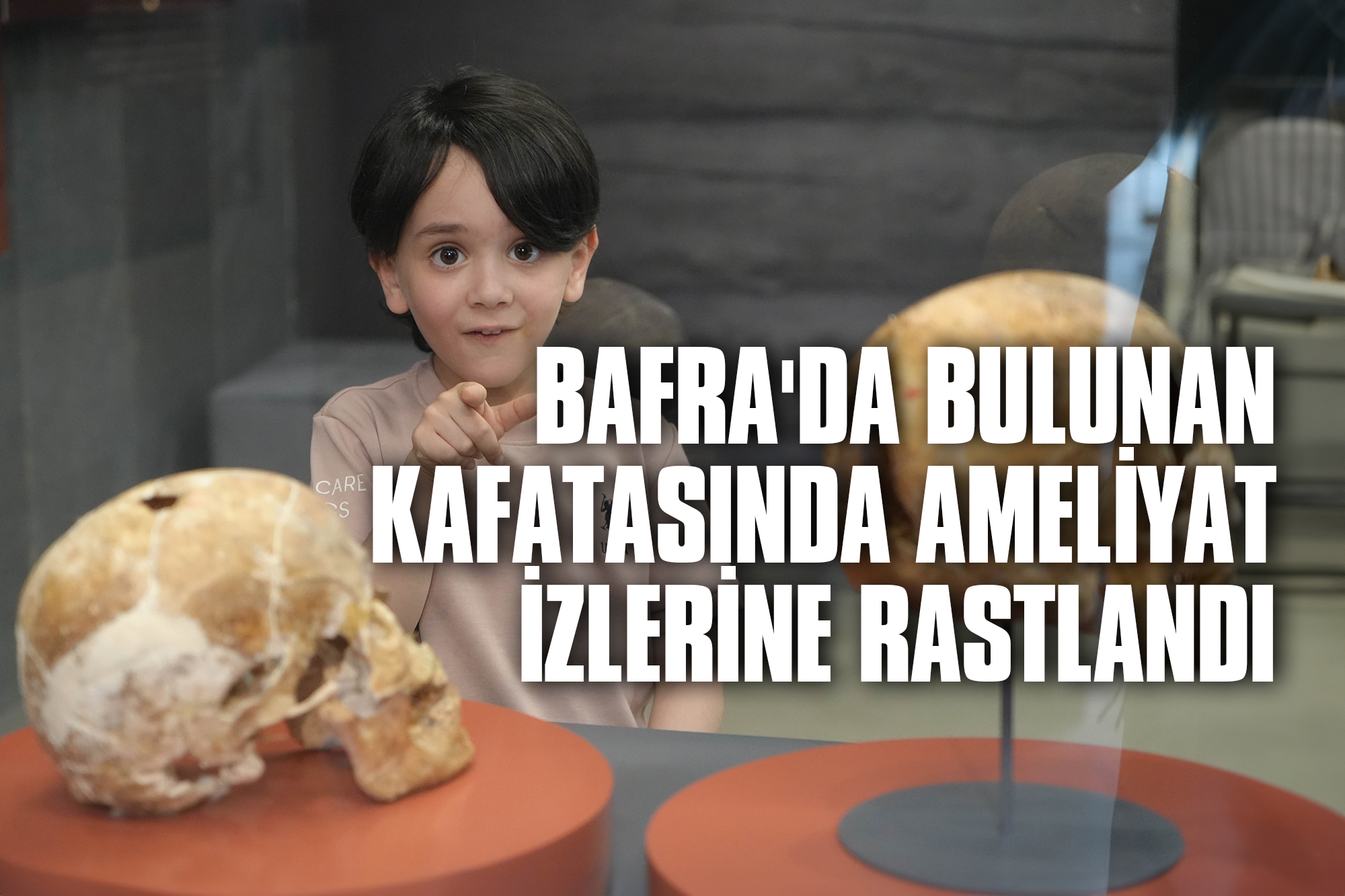 Bafra'da-Bulunan-Kafatasında-Ameliyat-İzlerine-Rastlandı