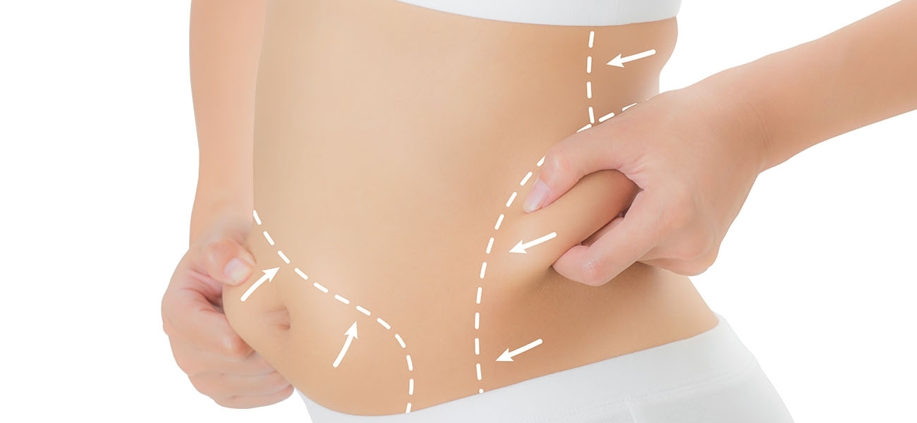 Liposuction Kimler için Uygundur? Nelere Dikkat Edilmelidir?