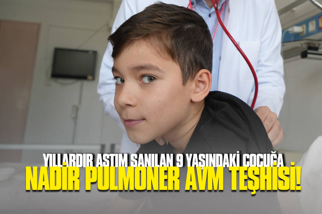 Yıllardır Astım Sanılan 9 Yaşındaki Çocuğa Nadir Pulmoner AVM Teşhisi!