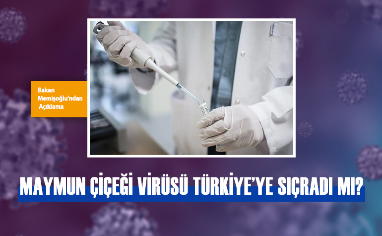 Maymun Çiçeği Virüsü Türkiye'ye Sıçradı mı? Bakan Memişoğlu'ndan Açıklama