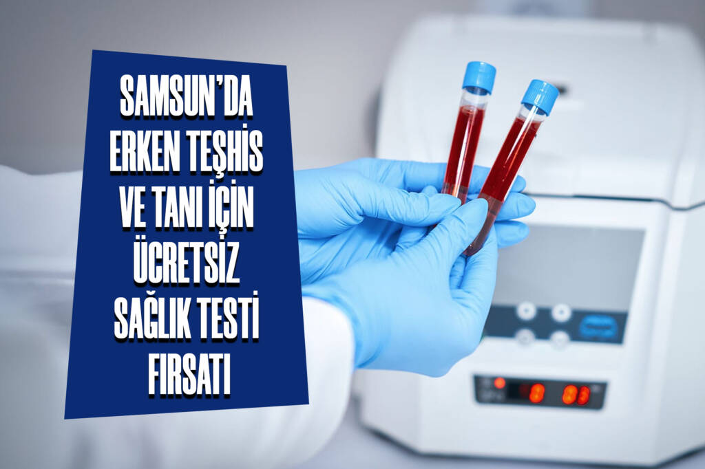 Samsun'da Erken Teşhis ve Tanı için Ücretsiz Sağlık Testi Fırsatı