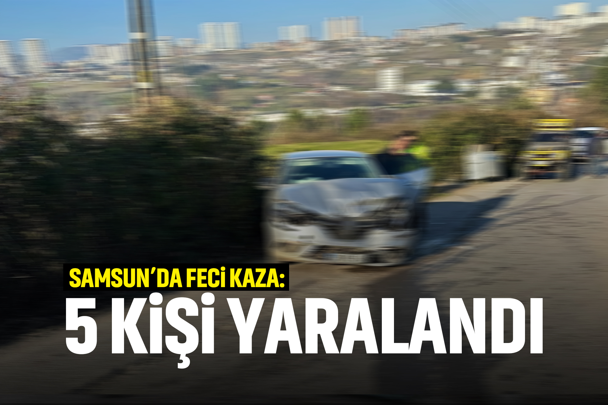 MANŞET 30 kopya