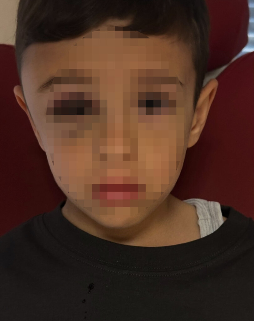 Parkta fırlatılan 7 yaşındaki güney'in babası: “ciddi yaptırımlar olmalı" samsun manşet haberleri Samsun manşet - samsun haberleri