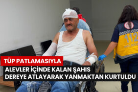 tup-patlamasiyla-alevler-icinde-kalan-sahis-dereye-atlayarak-yanmaktan-kurtuldu